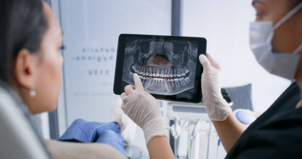 Licensed Tooth Extraction service in Lilburn, GA - Smile Center Dentistry